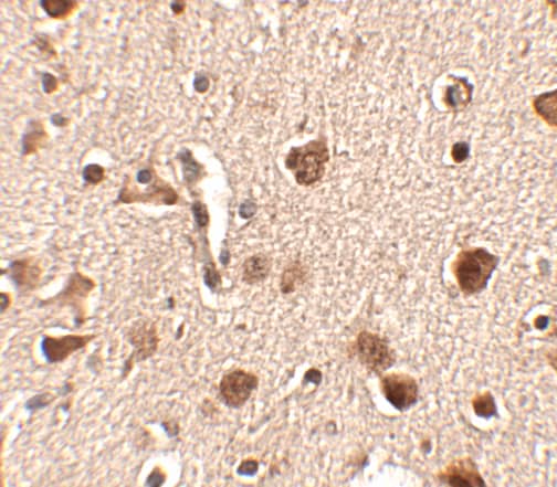 Immunohistochemistry SLITRK4 Antibody - BSA Free