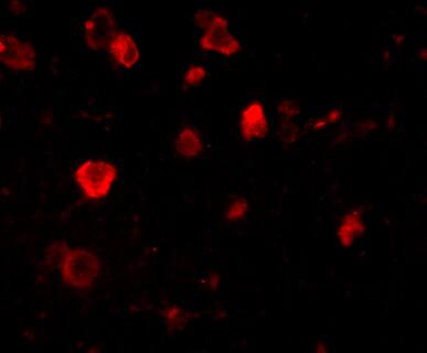 Immunocytochemistry/ Immunofluorescence SLITRK4 Antibody - BSA Free