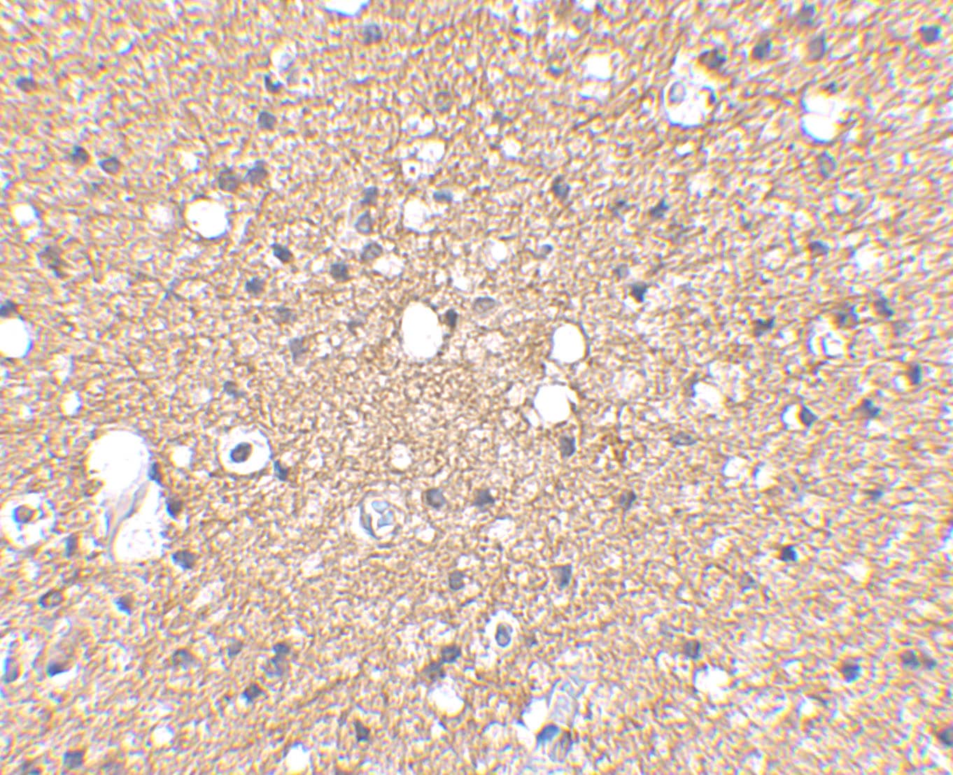 Immunohistochemistry: Sirtuin 2/SIRT2 Antibody - BSA Free [NBP1-76879] - Immunohistochemical staining of Human Brain tissue using Sirtuin 2/SIRT2 antibody at 2.5 u/mL.