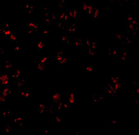 Immunocytochemistry/ Immunofluorescence: Bcl-10 Antibody - BSA Free [NBP1-76882] - Immunofluorescence of Bcl-10 in Raji cells with Bcl-10 antibody at 10 u/mL.