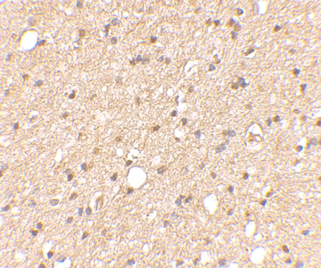 Immunohistochemistry: LGI2 Antibody - BSA Free [NBP1-76886] - Immunohistochemical staining of human brain tissue using LGI2 antibody at 2.5 ug/mL.