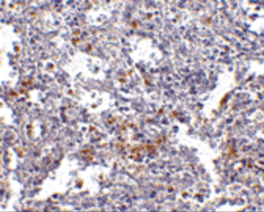 Immunohistochemistry: TMC6 Antibody - BSA Free [NBP1-76891] - Immunohistochemistry of TMC6 in human spleen with TMC6 antibody at 2.5 u/mL.