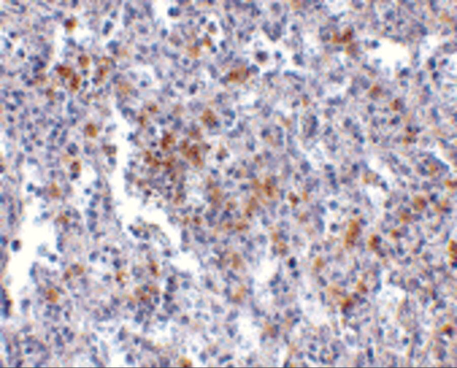 Immunohistochemistry: TMC6 Antibody - BSA Free [NBP1-76892] - Immunohistochemistry of TMC6 in human spleen with TMC6 antibody at 2.5 u/mL.