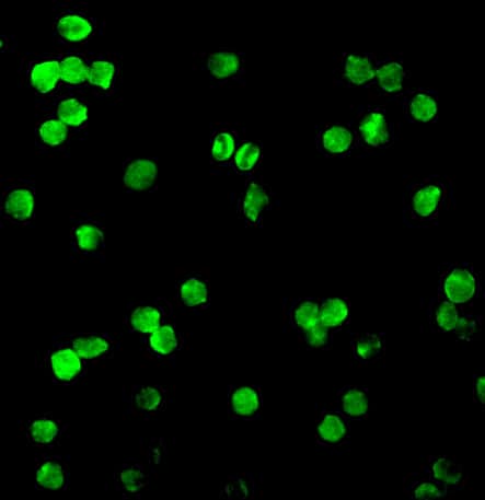 Immunocytochemistry/ Immunofluorescence: DRAK1 Antibody - BSA Free [NBP1-76896] - Immunofluorescence of DRAK1 in Molt cells with DRAK1 antibody at 20 ug/mL.