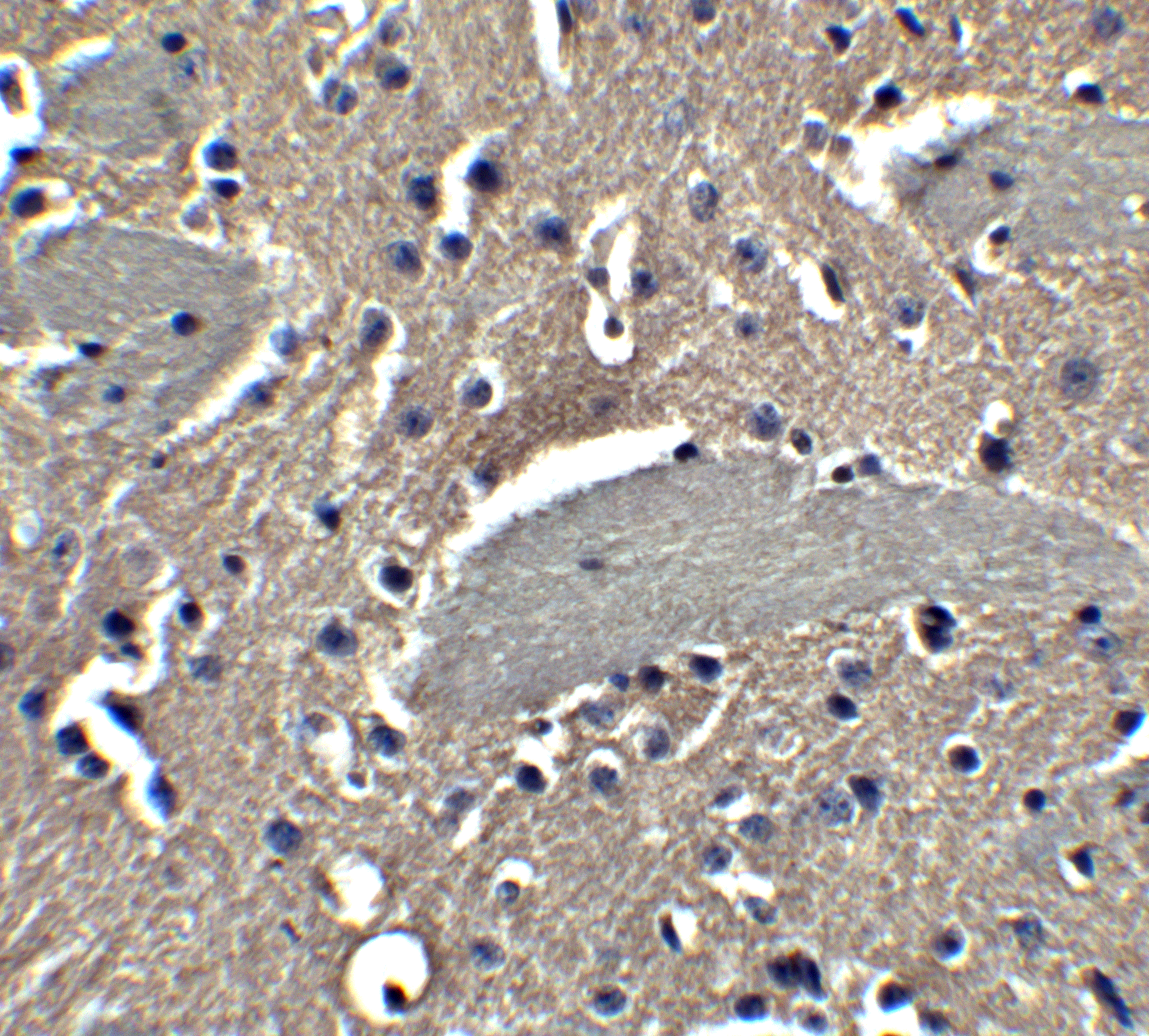 Immunohistochemistry: Neuronal Pentraxin 2 Antibody - BSA Free [NBP1-76899] - Validation of Neuronal Pentraxin 2 in Mouse Brain Tissue.Immunohistochemical analysis of paraffin-embedded mouse brain issue using anti-Neuronal Pentraxin 2 antibody at 5 ug/ml. Tissue was fixed with formaldehyde and blocked with 10% serum for 1 h at RT; antigen retrieval was by heat mediation with a citrate buffer (pH6). Samples were incubated with primary antibody overnight at 4C. A goat anti-rabbit IgG H&L (HRP) at 1/250 was used as secondary. Counter stained with Hematoxylin.