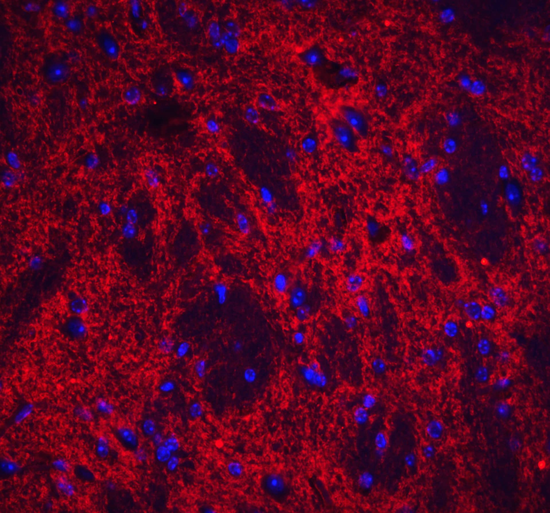 Immunocytochemistry/ Immunofluorescence: Neuronal Pentraxin 2 Antibody - BSA Free [NBP1-76899] - Validation of Neuronal Pentraxin 2 in Mouse Brain Tissue.Immunofluorescent analysis of 4% paraformaldehyde-fixed mouse brain issue labeling Neuronal Pentraxin 2 at 20 ug/mL, followed by goat anti-rabbit IgG secondary antibody at 1/500 dilution (red)  and DAPI staining (blue).  