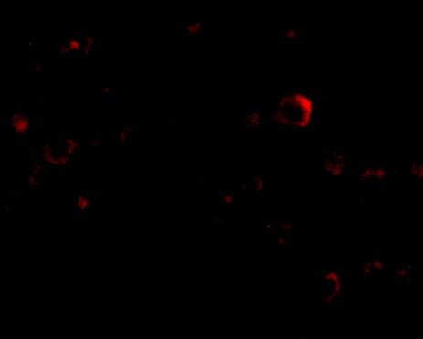 Immunocytochemistry/ Immunofluorescence: EVER2 Antibody - BSA Free [NBP1-76903] - Immunofluorescence of EVER2 in Human Brain cells with EVER2 antibody at 20 u/mL.