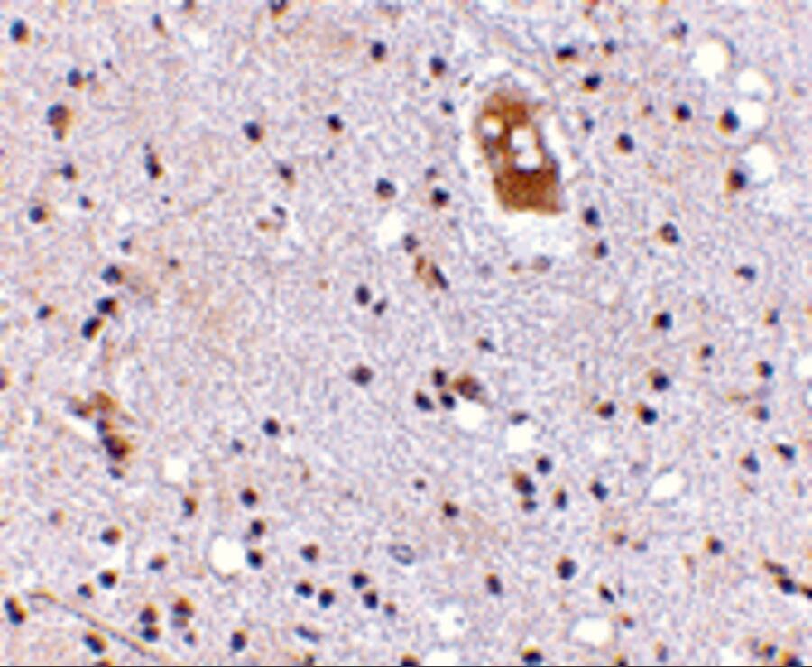 Immunohistochemistry: EVER2 Antibody - BSA Free [NBP1-76903] - Immunohistochemistry of EVER2 in human brain with EVER2 antibody at 5 u/mL.