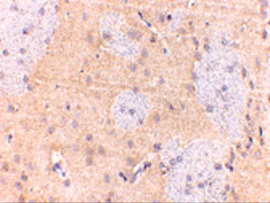 Immunohistochemistry: GPAM Antibody - BSA Free [NBP1-76907] - Immunohistochemistry of GPAM in rat brain with GPAM antibody at 2.5 u/mL.