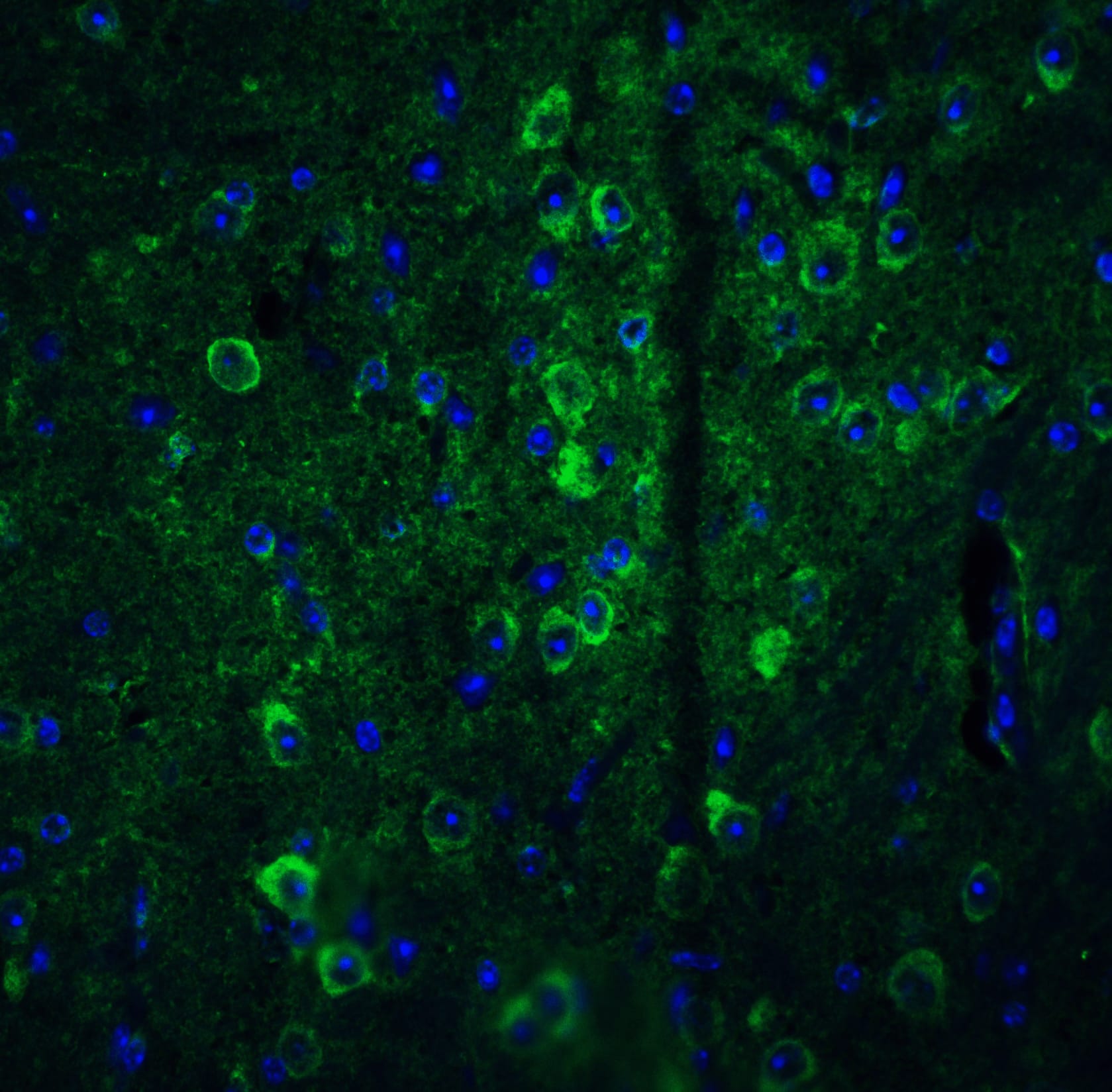 Immunocytochemistry/ Immunofluorescence: GPAM Antibody - BSA Free [NBP1-76907] - Immunofluorescence of GPAM in mouse brain tissue with GPAM antibody at 20 u/mL. Green: GPAM Antibody   Blue: DAPI staining