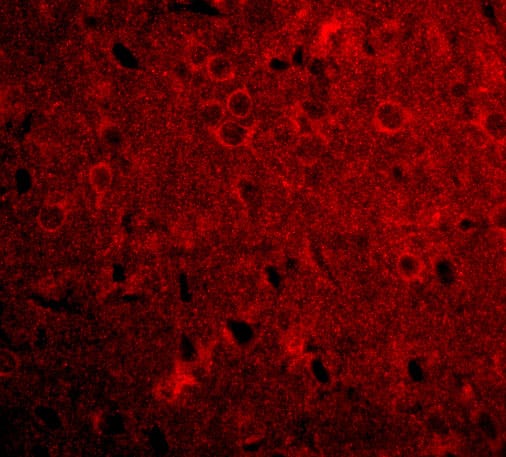 Immunocytochemistry/ Immunofluorescence: GPAM Antibody - BSA Free [NBP1-76907] - Immunofluorescence of GPAM in Rat Brain tissue with GPAM antibody at 20 u/mL.