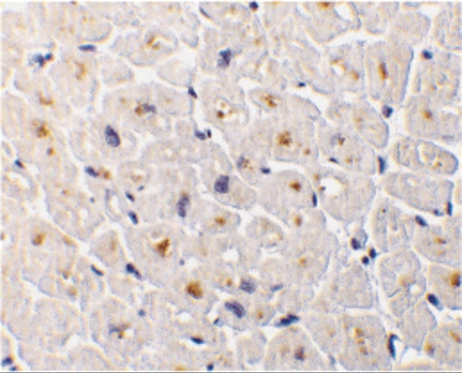 Immunohistochemistry: DcR3/TNFRSF6B Antibody - BSA Free [NBP1-76909] - Immunohistochemistry of DcR3/TNFRSF6B in human heart tissue with DcR3/TNFRSF6B antibody at 1 ug/mL.