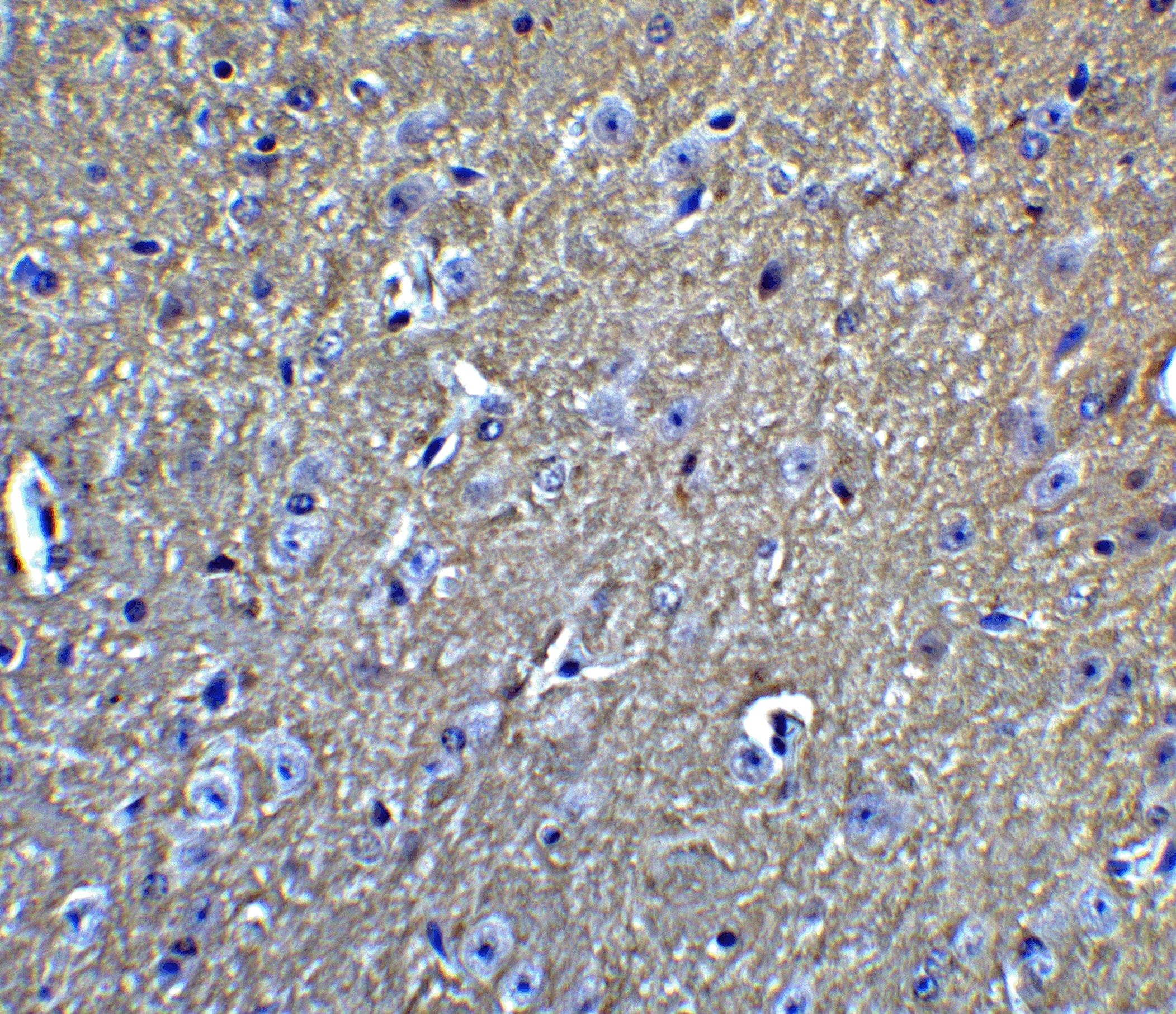 Immunohistochemistry: APP Antibody - BSA Free [NBP1-76910] - Immunohistochemistry of APP in mouse brain tissue with APP Antibody at 5 ug/mL.