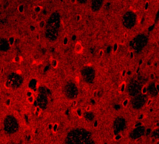 Immunocytochemistry/ Immunofluorescence: APP Antibody - BSA Free [NBP1-76910] - Immunofluorescence of APP in Rat Brain cells with APP antibody at 20 ug/mL.