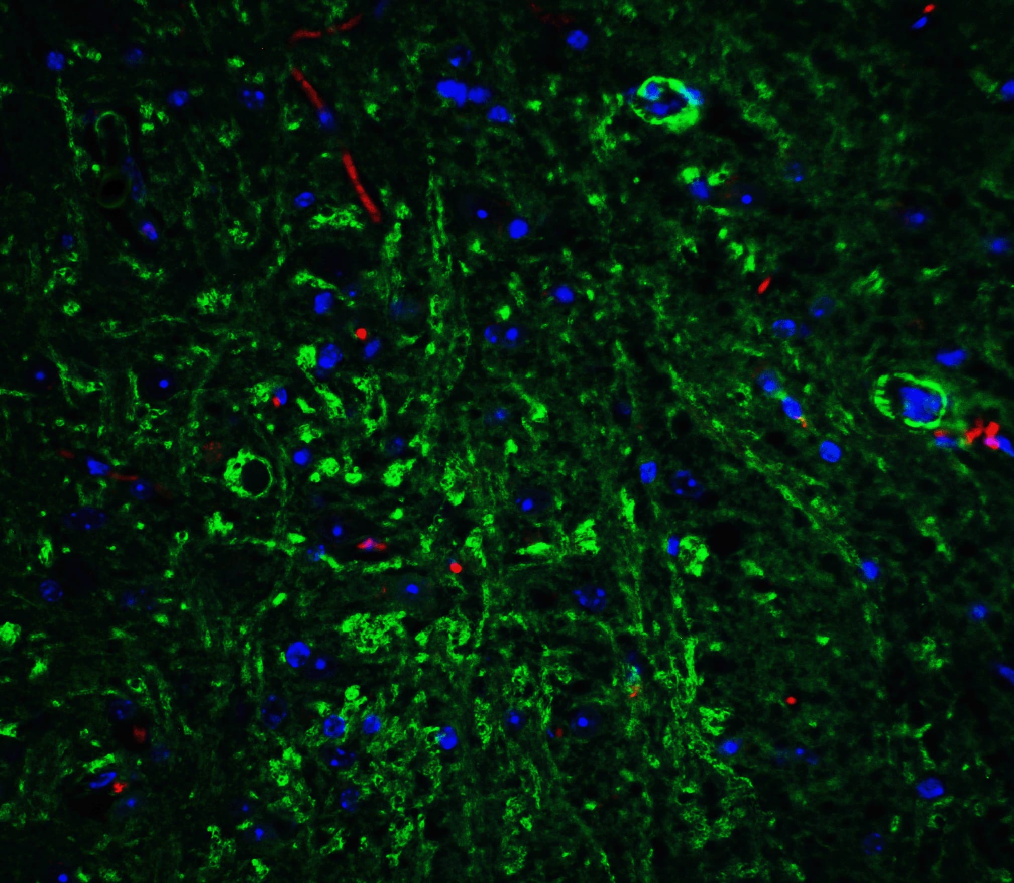 Immunocytochemistry/ Immunofluorescence: APP Antibody - BSA Free [NBP1-76910] - Immunofluorescence of APP in mouse brain tissue with APP Antibody at 20 ug/mL. Green: APP antibody   Red: Phylloidin staining Blue: DAPI staining