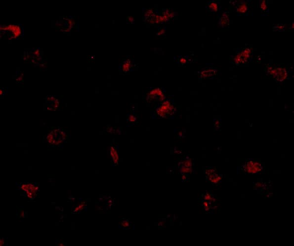 Immunocytochemistry/ Immunofluorescence GKAP/DLGAP1 Antibody - BSA Free