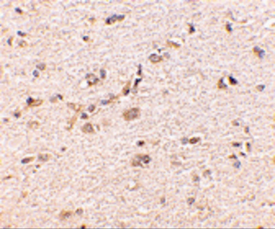 Immunohistochemistry GKAP/DLGAP1 Antibody - BSA Free