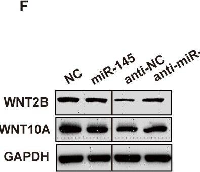WNT2B and WNT10A were real targets of miR-145 in CRC cells.(A), The binding sequence of miR-145 in WNT2B/WNT10A 3’UTR was inserted into the dual-luciferase reporter vector to generate the WT plasmids. In contrast, this binding sequence was deleted to generate MUT plasmids. (B-C), Following transfection with miR-145, the luciferase activities of WT and MUT reporters were assessed. (D-F), The mRNA and protein expression levels of WNT2B and WNT10A were detected in CRC cells with miR-145 or anti-miR-145 transfection into SW620 cells. (G-I) The mRNA and protein expression levels of WNT2B and WNT10A were examined by qRT-PCR and western blot examination in lincROR silencing or overexpressing SW620 cells. Data were shown as mean +/- SD (n = 3). *, P < 0.05; **, P < 0.01; ***, P < 0.001; versus the corresponding control group. Image collected and cropped by CiteAb from the following open publication (//dx.plos.org/10.1371/journal.pone.0312417), licensed under a CC-BY license. Not internally tested by Novus Biologicals.