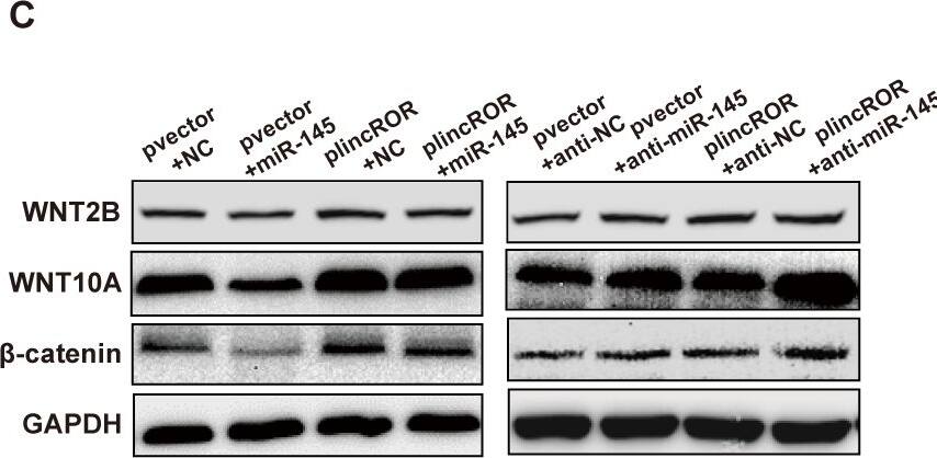 LincROR activated the Wnt/ beta -Catenin signalling pathway by targeting miR-145.(A-B), the mRNA expression levels of WNT2B and WNT10A were examined in the lincROR overexpressing SW620 cells with miR-145 or anti-miR-145 transfection. (C), The protein expression levels of  beta -catenin, WNT2B, and WNT10A were examined in the lincROR overexpressing SW620 cells with miR-145 or anti-miR-145 transfection. (D-E), The mRNA expression level of  beta -catenin was assessed in the lincROR overexpressing SW620 cells with miR-145 or anti-miR-145 transfection. F, The mRNA expression levels of several downstream targets of Wnt/ beta -catenin signalling were examined in the lincROR overexpressing SW620 cells with miR-145 or anti-miR-145 transfection. Data were shown as mean +/- SD (n = 3). *, P < 0.05; **, P < 0.01; ***, P < 0.001; versus the corresponding control group. Image collected and cropped by CiteAb from the following open publication (//dx.plos.org/10.1371/journal.pone.0312417), licensed under a CC-BY license. Not internally tested by Novus Biologicals.