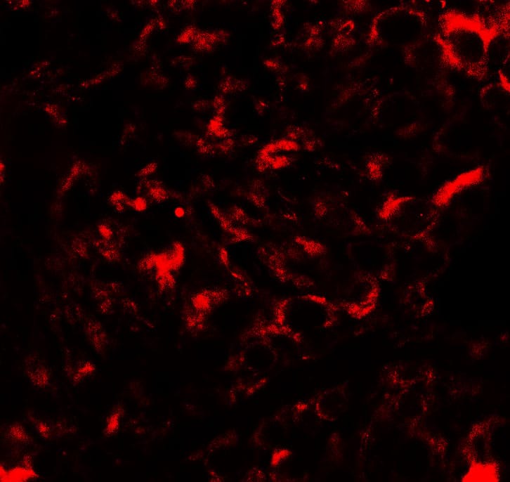 Immunocytochemistry/ Immunofluorescence Nanos2 Antibody - BSA Free