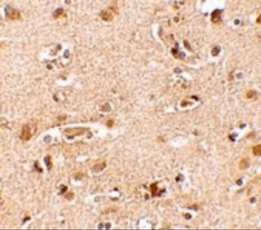 Immunohistochemistry: Nanos2 Antibody - BSA Free [NBP1-76917] - Immunohistochemistry of Nanos2 in human brain tissue cells with Nanos2 antibody at 2.5 u/mL.