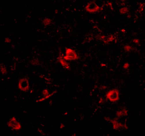 Immunocytochemistry/ Immunofluorescence Nanos3 Antibody - BSA Free