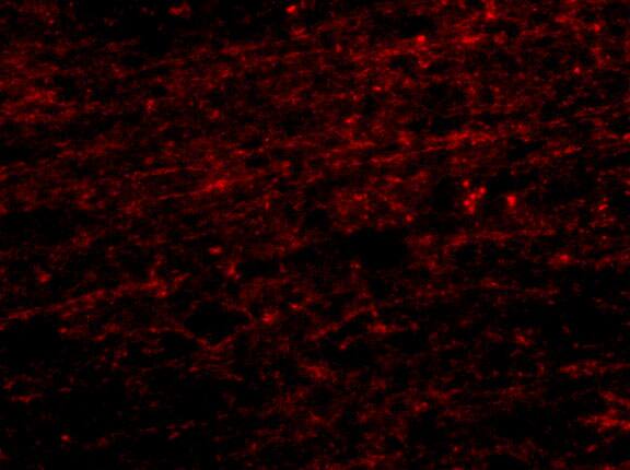 Immunocytochemistry/ Immunofluorescence: CLIP170 Antibody - BSA Free [NBP1-76921] - Immunofuorescence of CLIP170 in human brain tissue with CLIP170 antibody at 20 ug/mL.