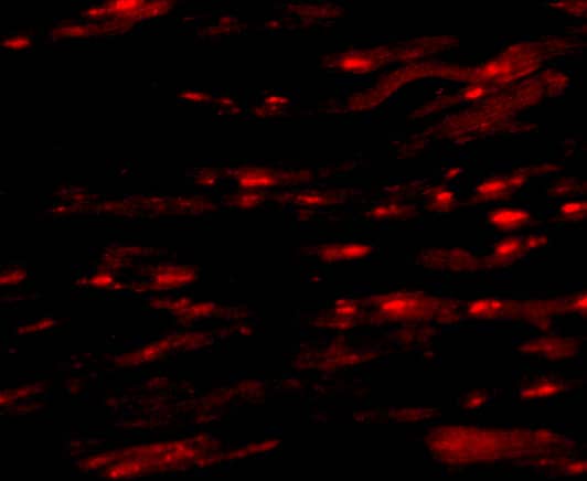 Immunocytochemistry/ Immunofluorescence: ASAH1 Antibody - BSA Free [NBP1-76933] - Immunofluorescence of ASAH1 in Human Heart cells with ASAH1 antibody at 20 u/mL.