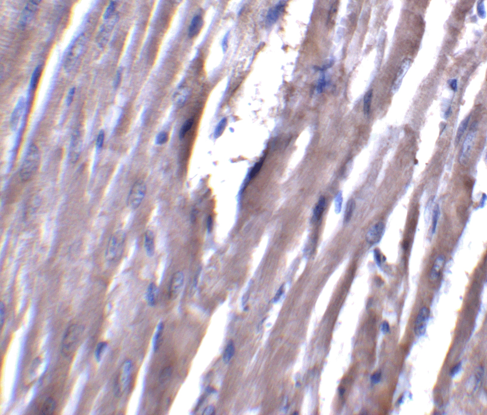 Immunohistochemistry: ASAH1 Antibody - BSA Free [NBP1-76933] - Immunohistochemistry of ASAH1 in rat heart tissue with ASAH1 antibody at 5 u/mL.