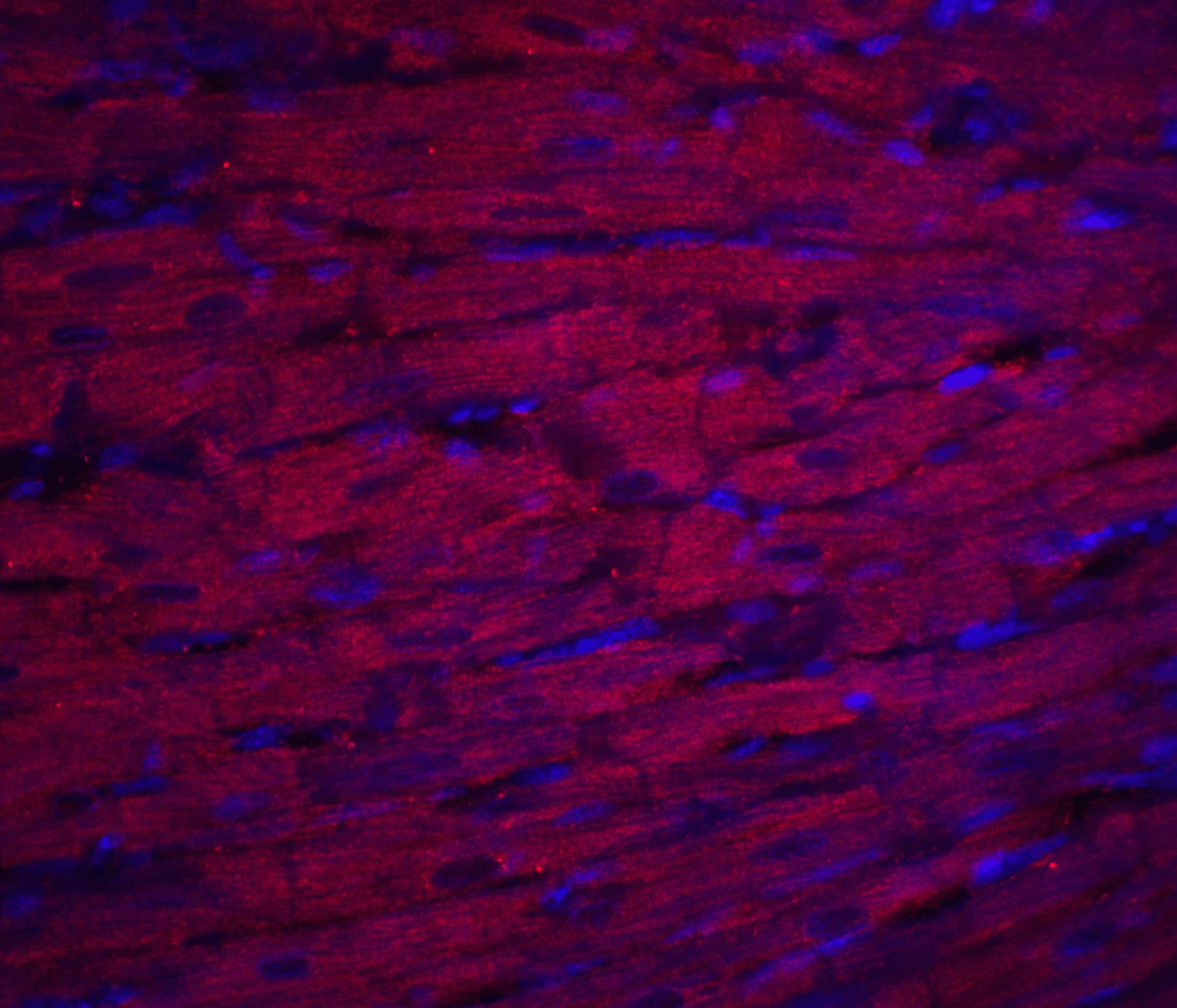 Immunohistochemistry: ASAH1 Antibody - BSA Free [NBP1-76933] - Immunofluorescence of ASAH1 in rat heart tissue with ASAH1 antibody at 20 u/mL.Red: ASAH1 Antibody   Blue: DAPI staining