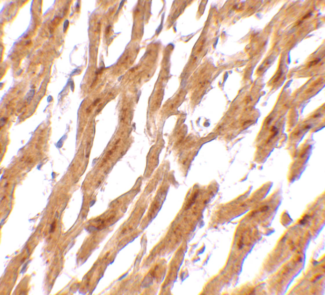 Immunohistochemistry: ASAH1 Antibody - BSA Free [NBP1-76933] - Immunohistochemistry of ASAH1 in human heart tissue with ASAH1 antibody at 2.5 ug/mL.