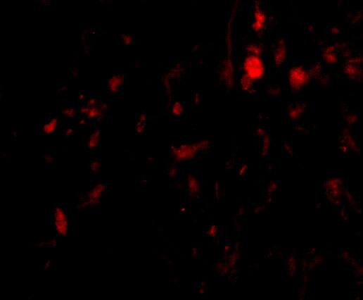 Immunocytochemistry/ Immunofluorescence Calpain 6 Antibody - BSA Free