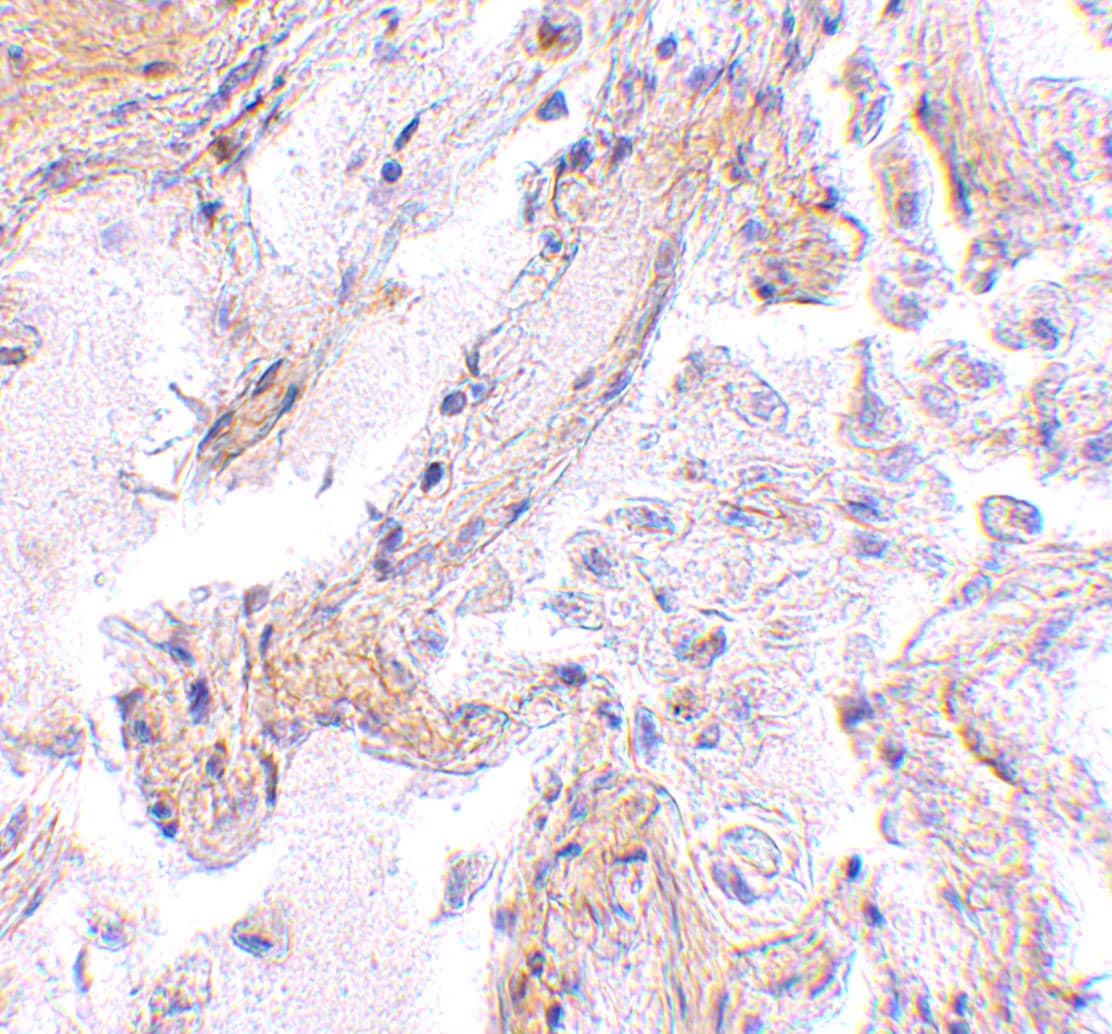 Immunohistochemistry Calpain 6 Antibody - BSA Free