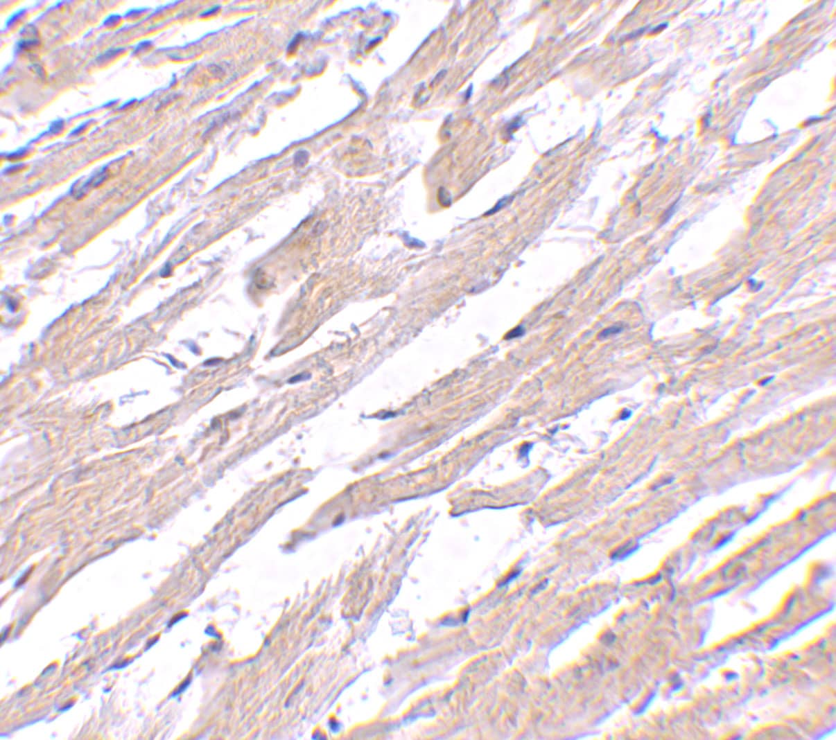 Immunohistochemistry: Protein O-Fucosyltransferase 1/POFUT1 Antibody - BSA Free [NBP1-76940] - Immunohistochemistry of Protein O-Fucosyltransferase 1/POFUT1 in human heart tissue with POFUT antibody at 2.5 ug/mL.