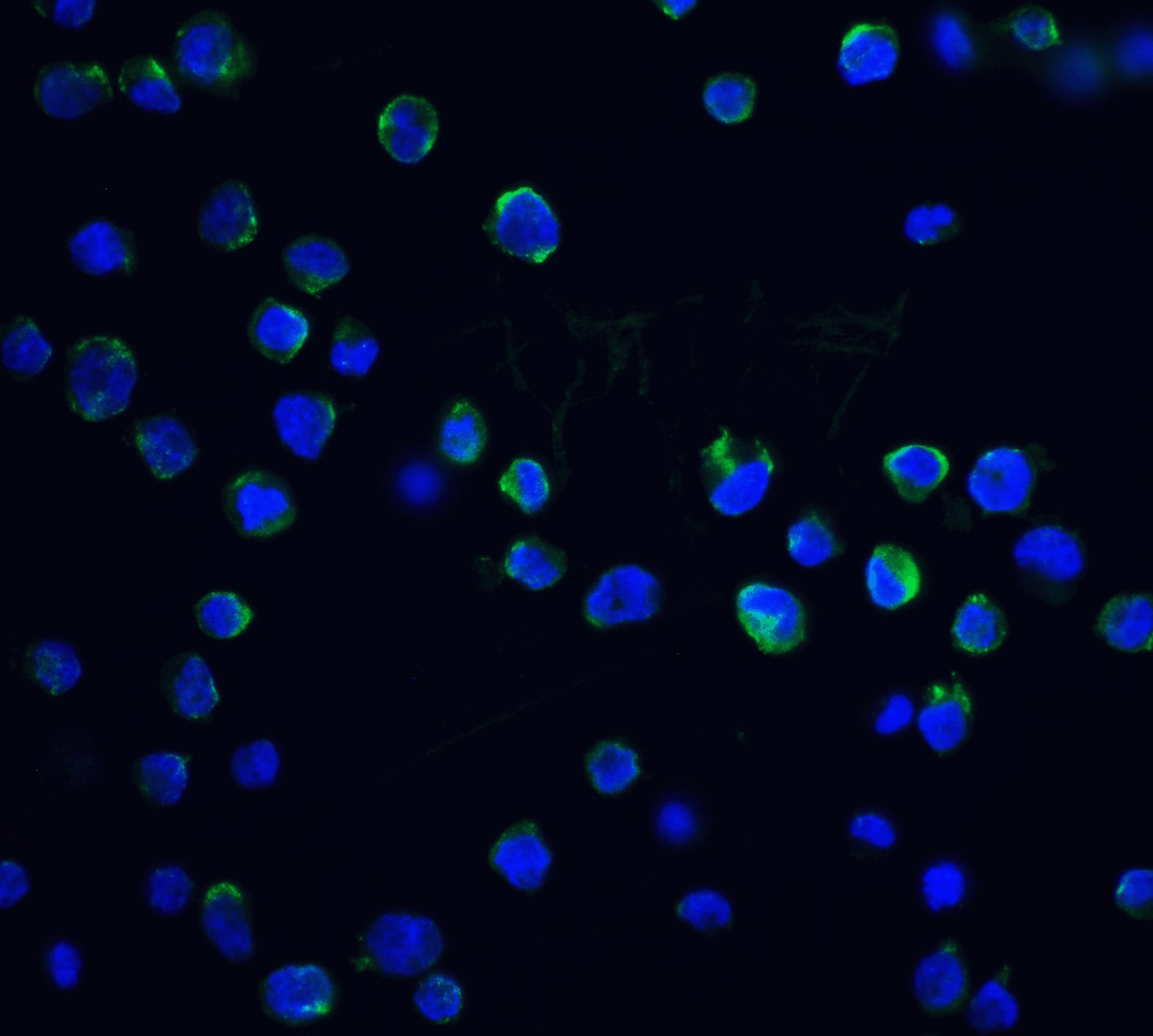 Immunocytochemistry/ Immunofluorescence: DFF40/CAD Antibody - BSA Free [NBP1-76948] - Immunofluorescence of DFF40/CAD in K562 cells with DFF40/CAD antibody at 20 u/ml.