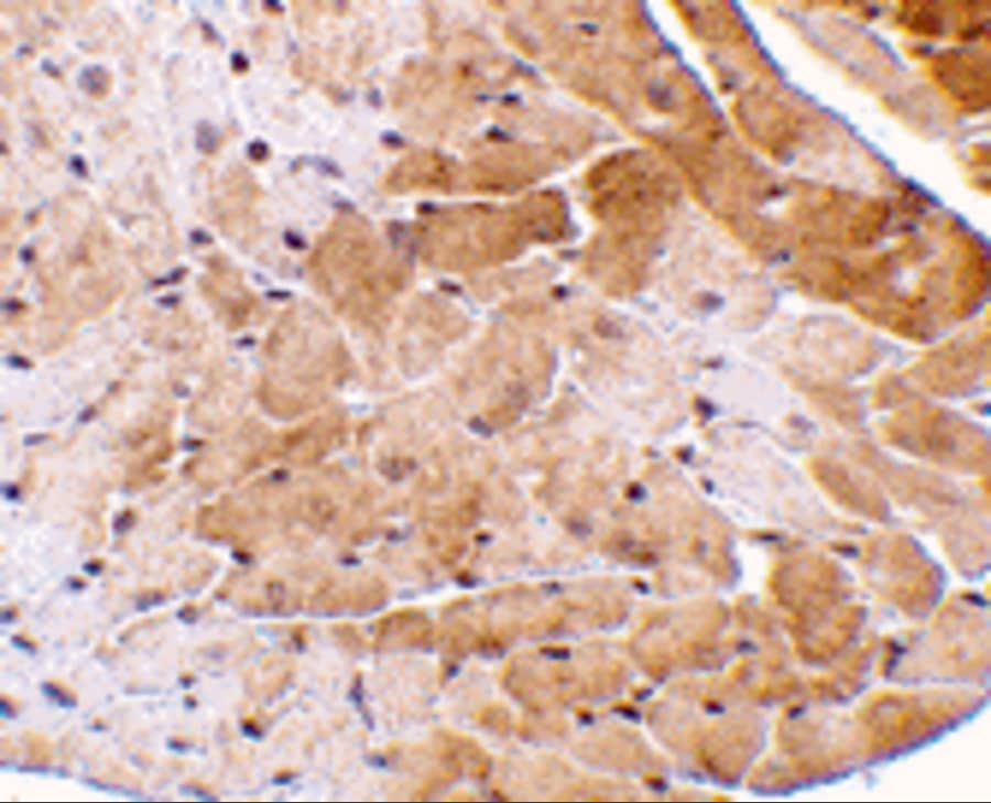 Immunohistochemistry: CIDEA Antibody - BSA Free [NBP1-76950] - Immunohistochemistry of CIDEA in mouse heart tissue with CIDEA antibody at 5 ug/mL.