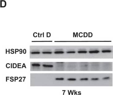Hepatic expression of FSP27 beta  strongly increased with the severity of NAFLD whereas CIDEA expression decreased. Wild-type mice fed a control diet (Ctrl D) (n = 4) or MCDD (n = 6) for 2 and 7 weeks. (A, B, C) Hepatic expression of CIDEA, CIDEB, FSP27 alpha  and FSP27 beta  was evaluated in Wt, Ctrl D and MCDD mice at the mRNA level (4–6 mice/group). The gene expression was normalized to the mRNA levels of B2M or 36B4. Results are expressed relative to the expression level in controls (means +/- SEM) and statistically analyzed using the Mann–Whitney test. (D) Hepatic expression of CIDEA, FSP27 and HSP90 was evaluated in Wt, Ctrl D and MCDD mice at the protein level (2–5 mice/group). *, versus Ctrl D, p < 0.05 Image collected and cropped by CiteAb from the following open publication (//pubmed.ncbi.nlm.nih.gov/31097771), licensed under a CC-BY license. Not internally tested by Novus Biologicals.