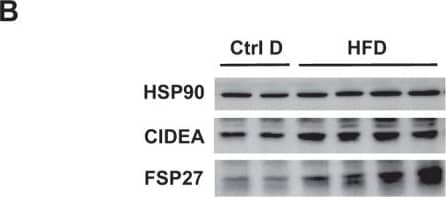 Hepatic expression of CIDEA, FSP27 alpha  and FSP27 beta  increased with hepatic steatosis induced by HFD challenge. Wild-type mice fed a control diet (Ctrl D) (n = 7) or HFD (n = 7) for 33 weeks. (A, C) Hepatic expression of CIDEA, CIDEB, FSP27 alpha  and FSB27 beta  was evaluated in Wt, Ctrl D and HFD mice at the mRNA level (7 mice/group). The gene expression was normalized to the mRNA levels of B2M or 36B4. Results are expressed relative to the expression level in controls (means +/- SEM) and statistically analyzed using the Mann–Whitney test. (B) Hepatic expression of CIDEA, FSP27 and HSP90 was evaluated in Wt, Ctrl D and HFD mice at the protein level (2–4 mice/group). *p < 0.05. Image collected and cropped by CiteAb from the following open publication (//pubmed.ncbi.nlm.nih.gov/31097771), licensed under a CC-BY license. Not internally tested by Novus Biologicals.