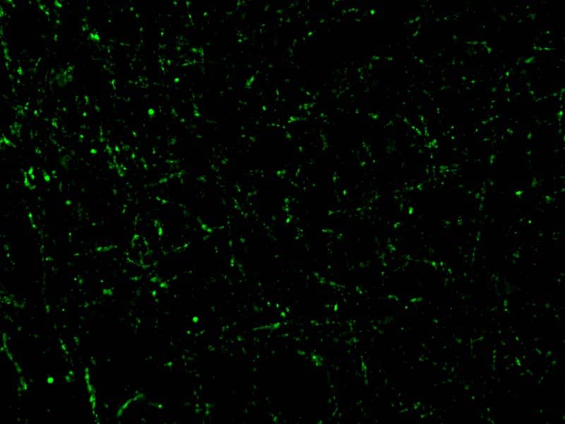 Immunocytochemistry/ Immunofluorescence: CIDEA Antibody - BSA Free [NBP1-76951] - Immunofluorescence of CIDEA in Human Brain cells with CIDEA antibody at 20 ug/mL.