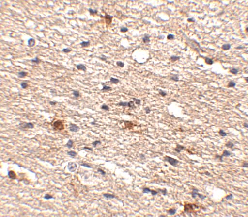 Immunohistochemistry: AIPL1 Antibody - BSA Free [NBP1-76953] - Immunohistochemistry of AIPL1 in human brain tissue with AIPL1 antibody at 2.5 ug/mL.