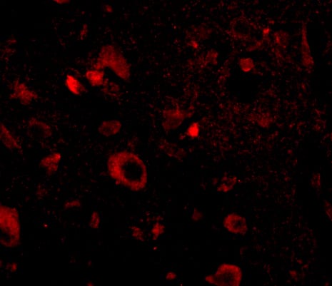 Immunocytochemistry/ Immunofluorescence: AIPL1 Antibody - BSA Free [NBP1-76953] - Immunofluorescence of aipl1 in human brain tissue with aipl1 antibody at 20 ug/mL.