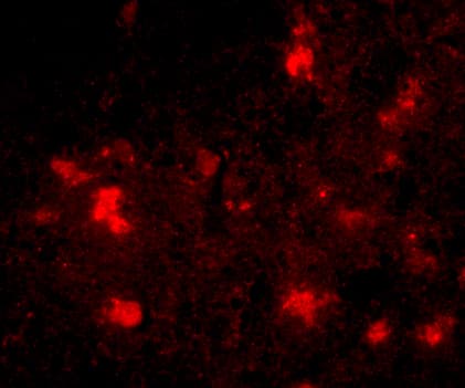 Immunocytochemistry/ Immunofluorescence Dact2 Antibody - BSA Free