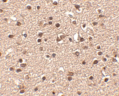 Immunohistochemistry Dact2 Antibody - BSA Free