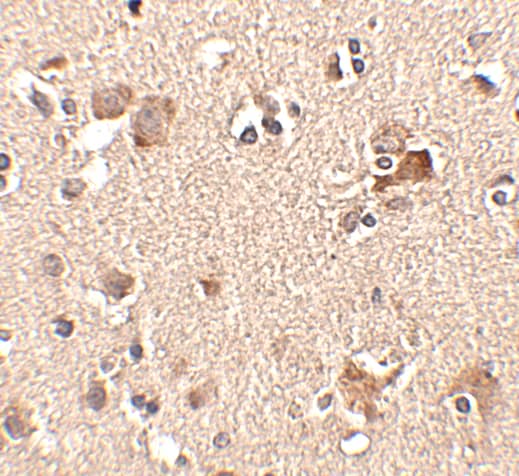 Immunohistochemistry: AIPL1 Antibody - BSA Free [NBP1-76956] - Immunohistochemistry of AIPL1 in human brain tissue with AIPL1 antibody at 2.5 ug/mL.