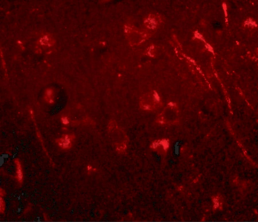 Immunocytochemistry/ Immunofluorescence: AIPL1 Antibody - BSA Free [NBP1-76956] - Immunofluorescence of aipl1 in human brain tissue with aipl1 antibody at 20 ug/mL.