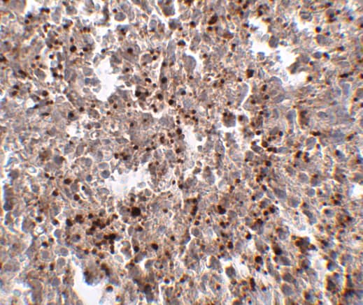 Immunohistochemistry: METTL7B Antibody - BSA Free [NBP1-76958] - Immunohistochemistry of Mett7LB in human spleen tissue with METTL7B antibody at 2.5 ug/mL.