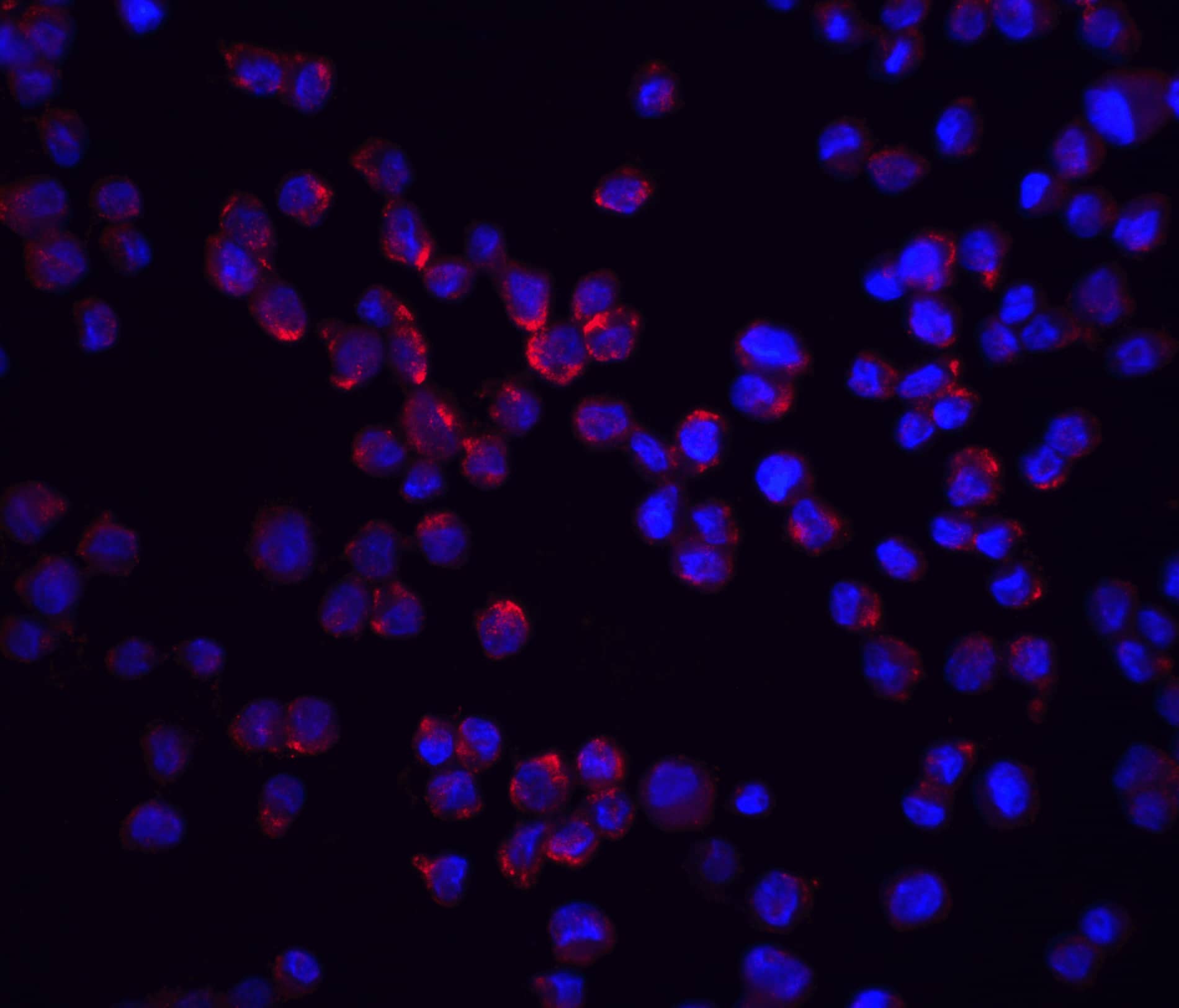 Immunocytochemistry/ Immunofluorescence: RIPK2 Antibody - BSA Free [NBP1-76960] - Immunofluorescence of RIPK2 in K562 cells with RIPK2 antibody at 20 u/mL.Red: RIPK2 Antibody   Blue: DAPI staining