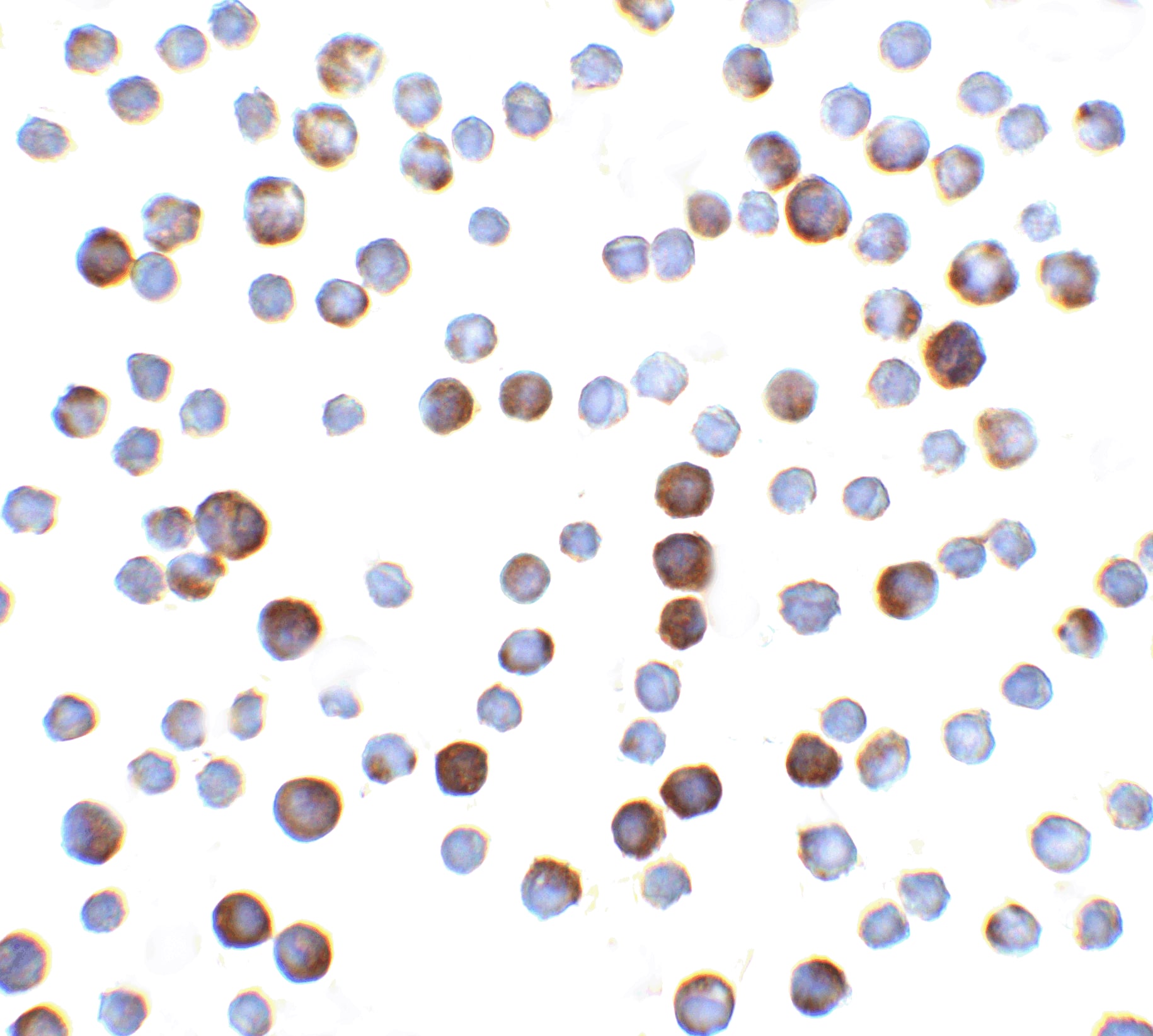 Immunocytochemistry/ Immunofluorescence: Caspase-9 Antibody - BSA Free [NBP1-76961] - Figure 6 Immunocytochemistry Validation of Caspase 9 in HeLa CellsImmunocytochemical analysis of HeLa cells using anti-Caspase 9 antibody  at 5 u/ml. Cells was fixed with formaldehyde and blocked with 10% serum for 1 h at RT; antigen retrieval was by heat mediation with a citrate buffer (pH6). Samples were incubated with primary antibody overnight at 4C. A goat anti-rabbit IgG H&L (HRP) at 1/250 was used as secondary. Counter stained with Hematoxylin.