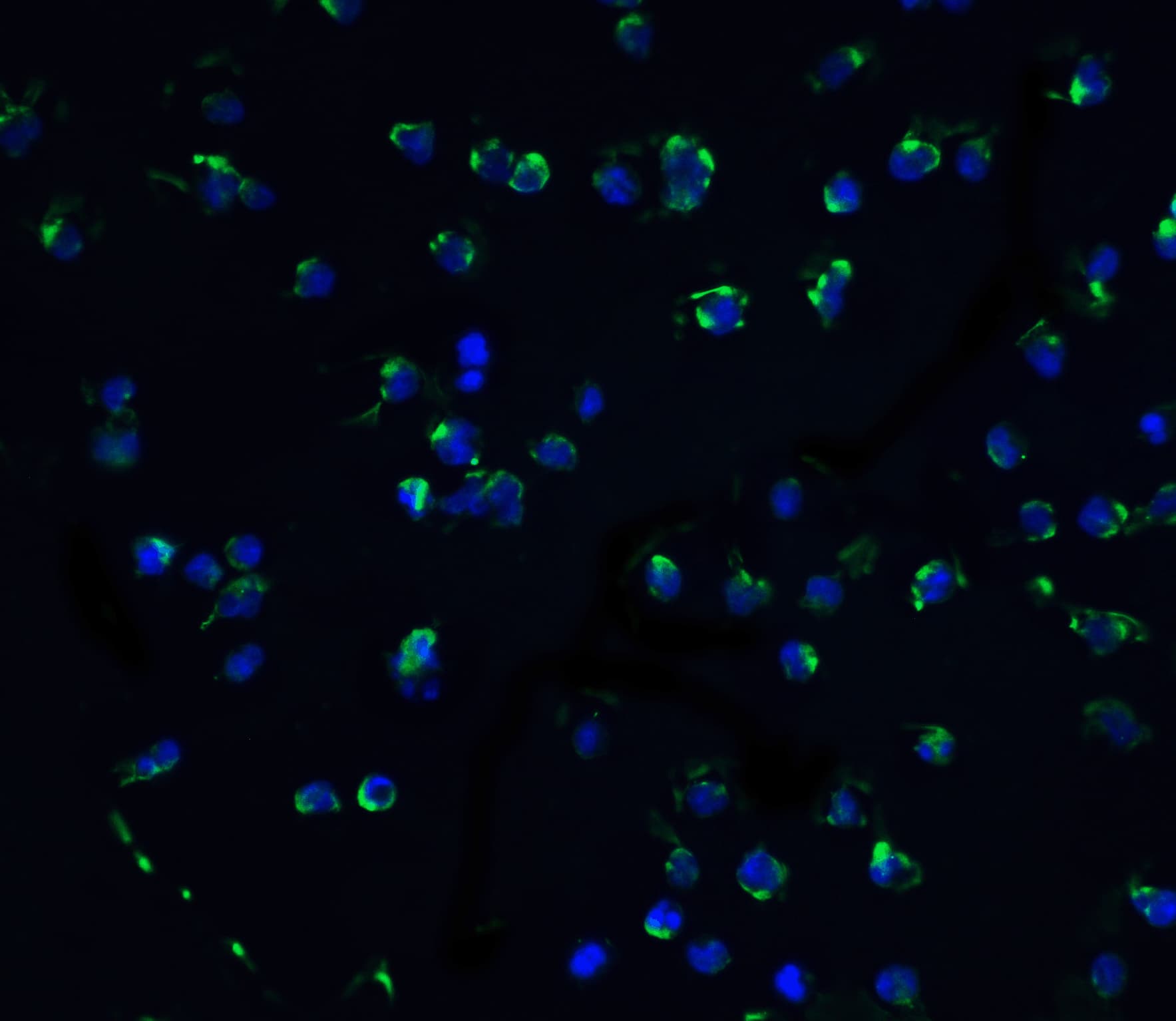 Immunocytochemistry/ Immunofluorescence DAPK3/ZIPK Antibody - BSA Free