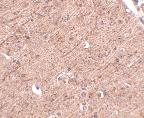 Immunohistochemistry Lass5 Antibody - BSA Free